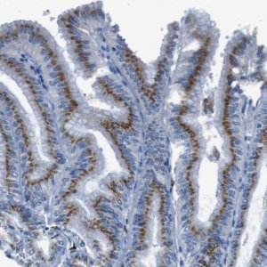 Anti-SLC35A3 antibody produced in rabbit 