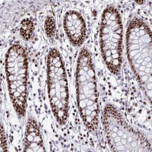 Anti-SLC35C2 antibody produced in rabbit 