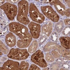 Anti-SLC35E2B antibody produced in rabbit 