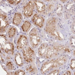 Anti-SLC35F2 antibody produced in rabbit 