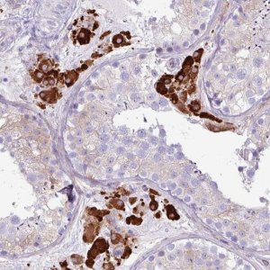 Anti-SLC38A1 antibody produced in rabbit 