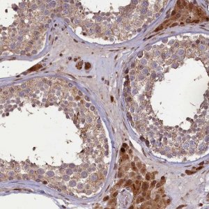 Anti-SLC38A7 antibody produced in rabbit 