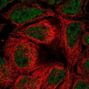 Anti-SLC39A10 antibody produced in rabbit 