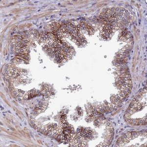 Anti-SLC39A6 antibody produced in rabbit 