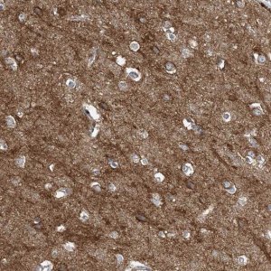 Anti-SLC4A10 antibody produced in rabbit 