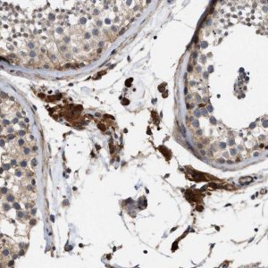 Anti-SLC4A11 antibody produced in rabbit 