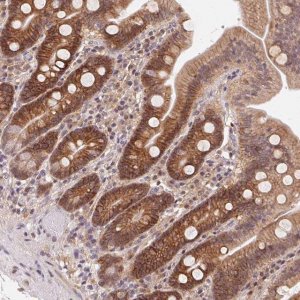 Anti-SLC52A2 antibody produced in rabbit 