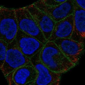 Anti-SLITRK6 antibody produced in rabbit 