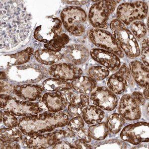 Anti-SMC4 antibody produced in rabbit 