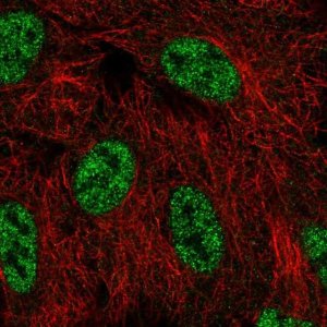 Anti-SMG1 antibody produced in rabbit 