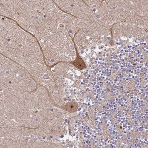 Anti-SMG6 antibody produced in rabbit 