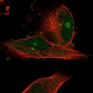 Anti-SMG6 antibody produced in rabbit 