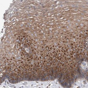 Anti-SMG7 antibody produced in rabbit 