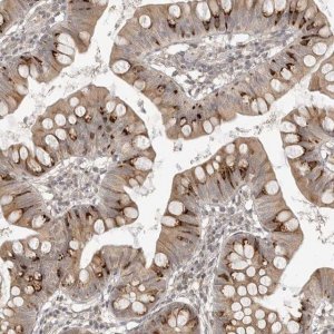 Anti-SMG8 antibody produced in rabbit 