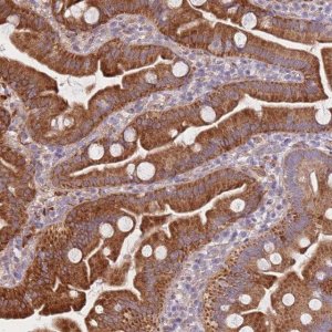 Anti-SMPD4 antibody produced in rabbit 