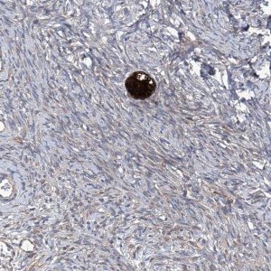 Anti-SMS antibody produced in rabbit 