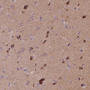 Anti-SNCAIP antibody produced in rabbit 