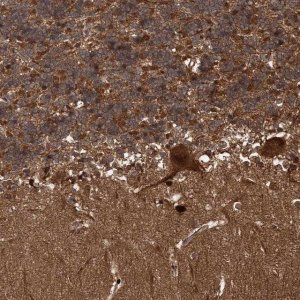 Anti-SNRNP25 antibody produced in rabbit 