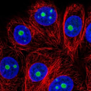 Anti-SNRNP35 antibody produced in rabbit 