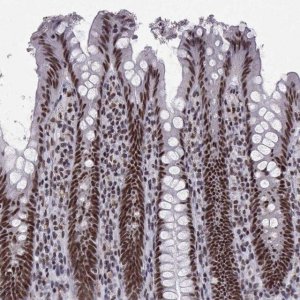 Anti-SNRPB2 antibody produced in rabbit 