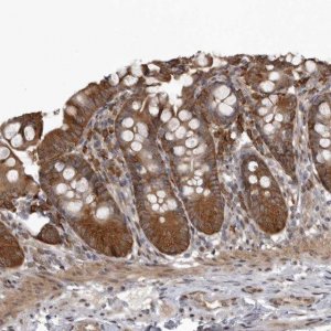 Anti-SNX16 antibody produced in rabbit 