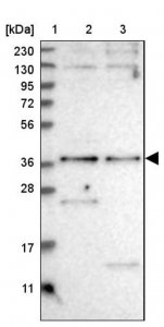 Anti-SNX16 antibody produced in rabbit 