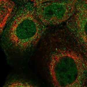 Anti-SNX22 antibody produced in rabbit 