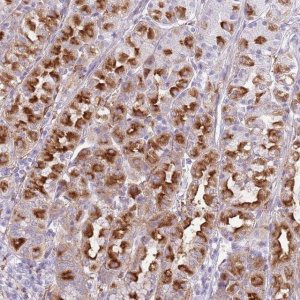 Anti-SNX6 antibody produced in rabbit 