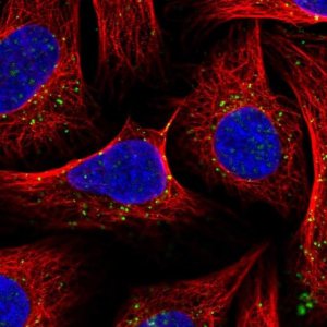 Anti-SNX6 antibody produced in rabbit 