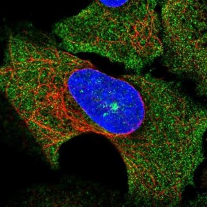 Anti-SOCS3 antibody produced in rabbit 