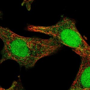 Anti-SOCS4 antibody produced in rabbit 
