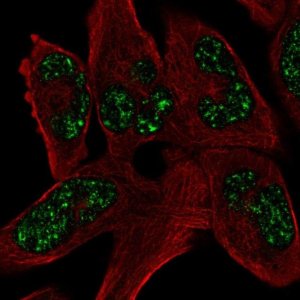 Anti-SOHLH1 antibody produced in rabbit 