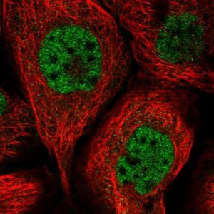 Anti-SORBS2 antibody produced in rabbit 