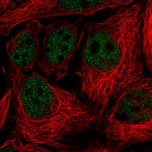 Anti-SORBS3 antibody produced in rabbit 