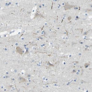Anti-SORCS1 antibody produced in rabbit 