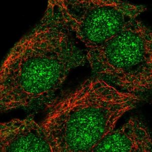 Anti-SORCS2 antibody produced in rabbit 
