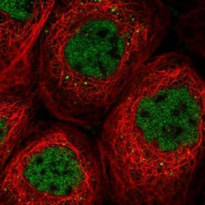 Anti-SOS2 antibody produced in rabbit 