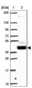 Anti-SOWAHD antibody produced in rabbit 