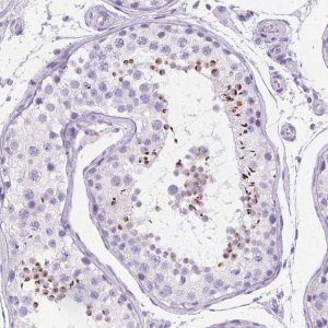 Anti-SPACA5 antibody produced in rabbit 