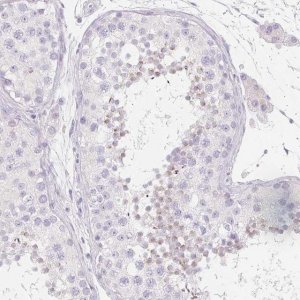 Anti-SPACA5B antibody produced in rabbit 