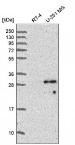 Anti-SPAG7 antibody produced in rabbit 
