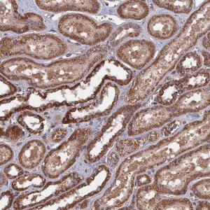 Anti-SPANXN4 antibody produced in rabbit 