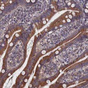 Anti-SPATA13 antibody produced in rabbit 