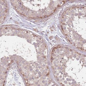 Anti-SPATA31D1 antibody produced in rabbit 