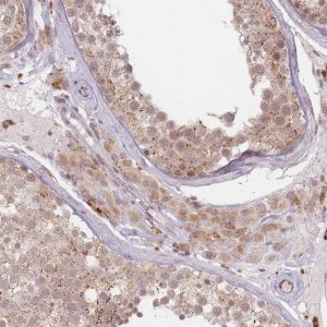 Anti-SPATA45 antibody produced in rabbit 