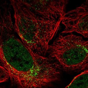 Anti-SPATA6 antibody produced in rabbit 