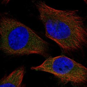 Anti-SPC25 antibody produced in rabbit 