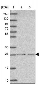 Anti-SPDYE1 antibody produced in rabbit HPA051750-100UL