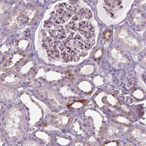 Anti-SPECC1L antibody produced in rabbit 