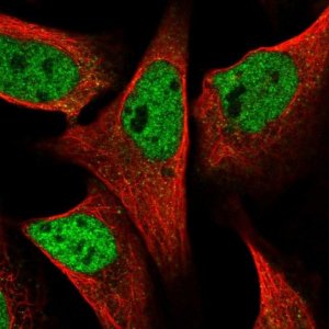 Anti-SPIDR antibody produced in rabbit 
